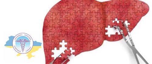 Liver transplantation in Belarus