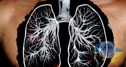 Lung transplantation in India