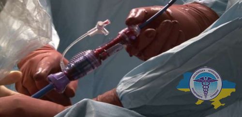 Транскатетерна імплантація аортального клапана в Польщі
