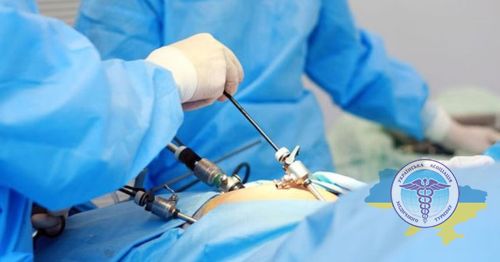 Малоинвазивная хирургия при раке желудка