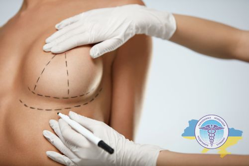 Surgical female breast augmentation