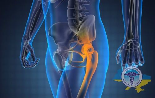 Bone metastases in cancer