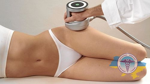Non-invasive methods of liposuction