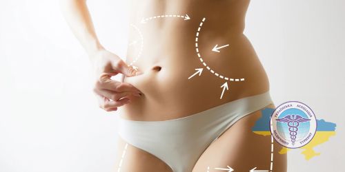 Modern methods of liposuction
